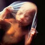 Image for Thursday of the Second Week in Ordinary Time; Day of Prayer for the Legal Protection of Unborn Children (USA); 